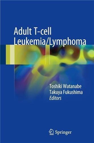 Adult T-cell Leukemia/Lymphoma 2017 Edition by Toshiki Watanabe, ISBN-13: 978-4431565215