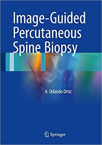 Image-Guided Percutaneous Spine Biopsy by A.Orlando Ortiz, ISBN-13: 978-3319433240