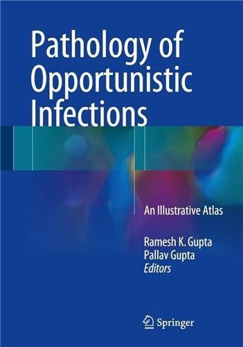 Pathology of Opportunistic Infections: An Illustrative Atlas, ISBN-13: 978-9811016684