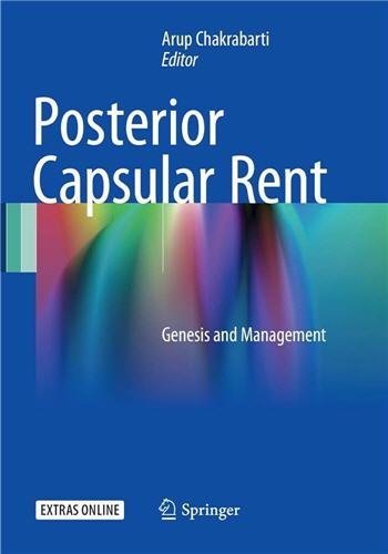Posterior Capsular Rent: Genesis and Management 2017 Edition by Arup Chakrabarti, ISBN-13: 978-8132235842