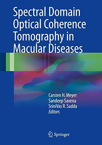 Spectral Domain Optical Coherence Tomography in Macular Diseases, ISBN-13: 978-8132236085